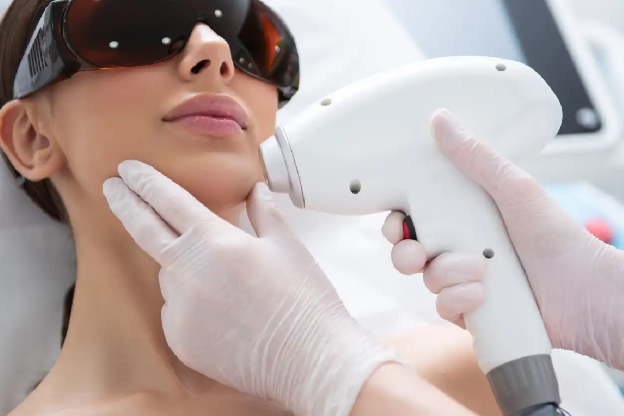 Laser Hair Reduction