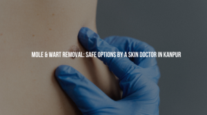 The best dermatologist in Kanpur provides you with expert tips to help you restore your skin’s hydration and health.
