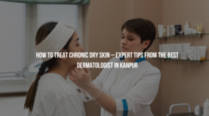 skin doctor in kanpurskin doctor in kanpurskin doctor in kanpur