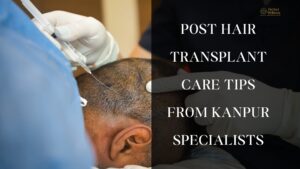 Post Hair Transplant Care Tips from Kanpur Specialists